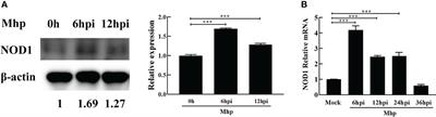Mycoplasma hyopneumoniae Infection Activates the NOD1 Signaling Pathway to Modulate Inflammation